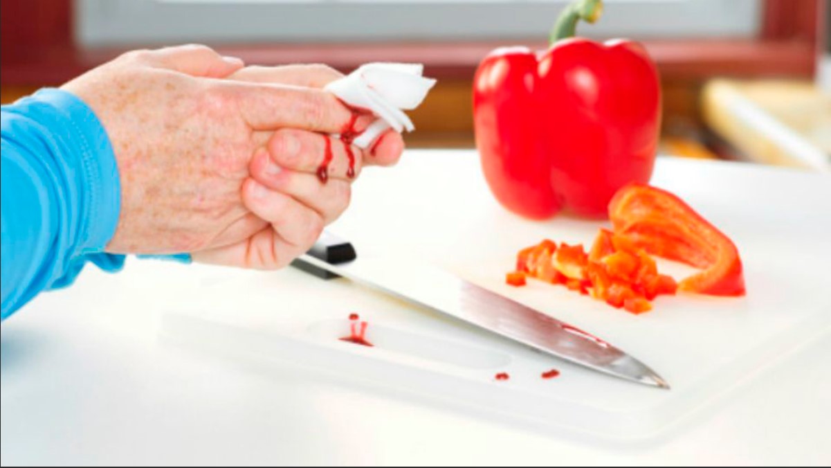 Самая частая неприятность на кухне-порез ножом пальцев рук.